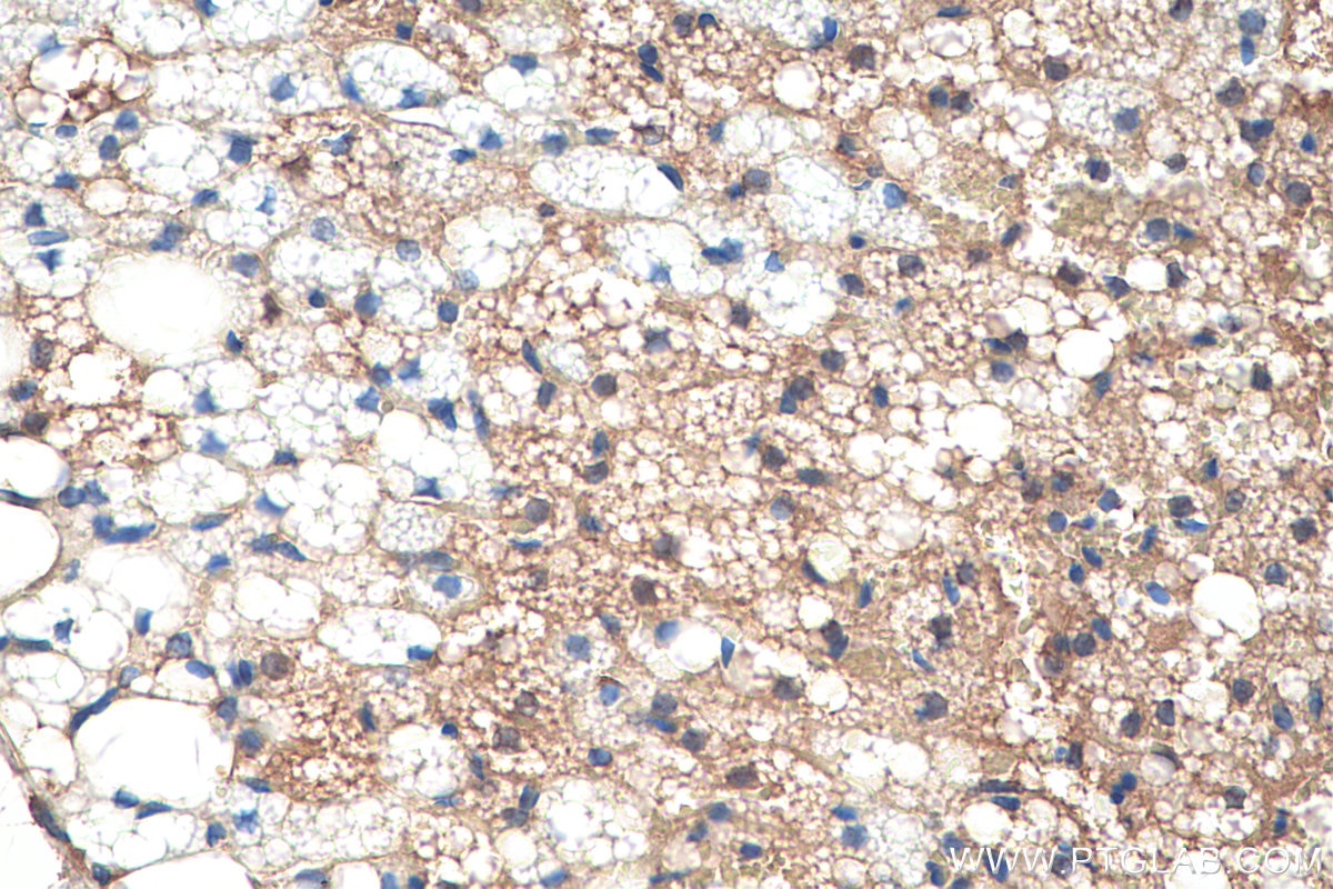 Immunohistochemical analysis of paraffin-embedded rat brown adipose tissue slide using KHC0229 (ADRP IHC Kit).