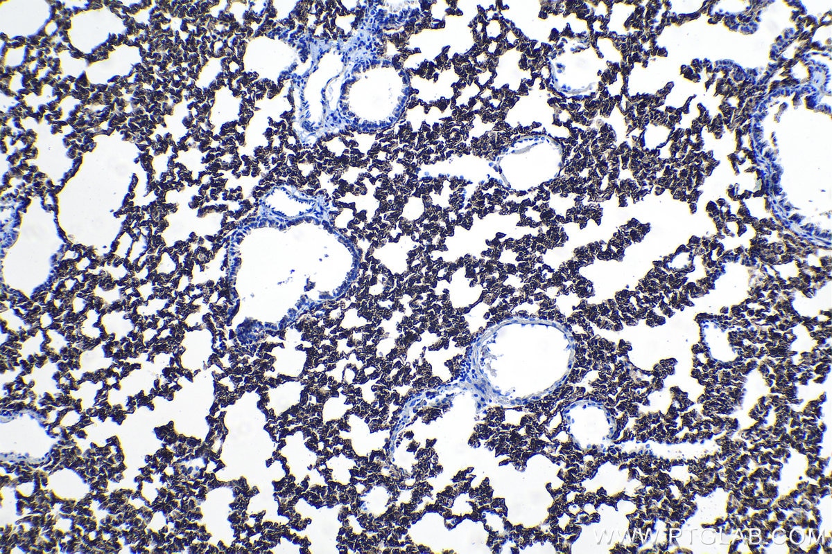 Immunohistochemical analysis of paraffin-embedded mouse lung tissue slide using KHC1095 (AGER IHC Kit).