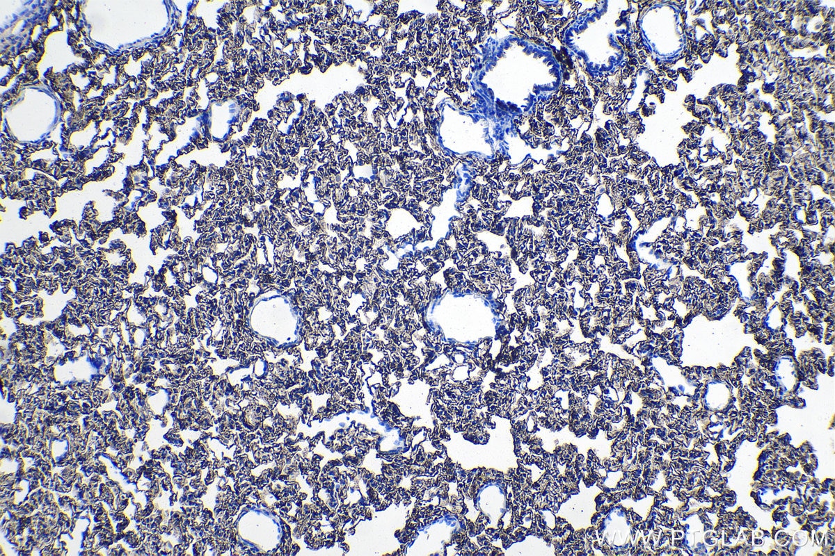 Immunohistochemical analysis of paraffin-embedded rat lung tissue slide using KHC1095 (AGER IHC Kit).