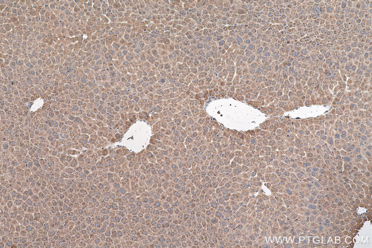 Immunohistochemical analysis of paraffin-embedded mouse liver tissue slide using KHC0797 (AGO2/EIF2C2 IHC Kit).