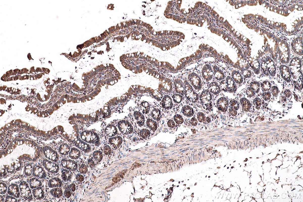 Immunohistochemical analysis of paraffin-embedded rat small intestine tissue slide using KHC0797 (AGO2/EIF2C2 IHC Kit).