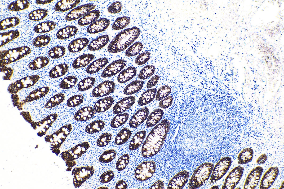 Immunohistochemical analysis of paraffin-embedded human colon tissue slide using KHC0653 (AGR2 IHC Kit).