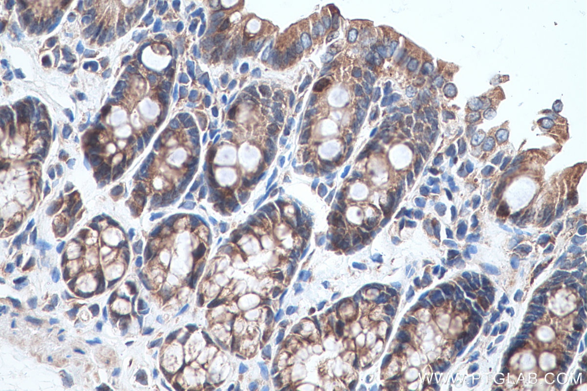 Immunohistochemical analysis of paraffin-embedded rat colon tissue slide using KHC0693 (AGR3 IHC Kit).