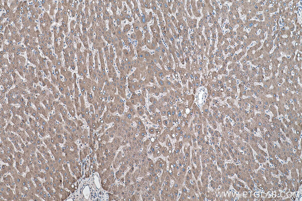 Immunohistochemical analysis of paraffin-embedded human liver tissue slide using KHC0490 (AGT IHC Kit).