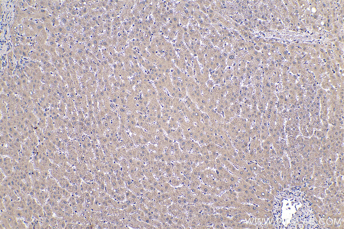 Immunohistochemical analysis of paraffin-embedded human liver tissue slide using KHC0507 (AGXT IHC Kit).