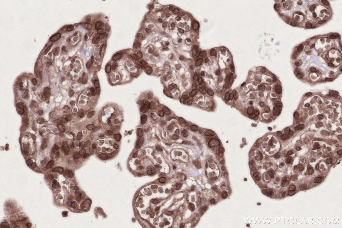Immunohistochemical analysis of paraffin-embedded human placenta tissue slide using KHC2744 (AHCTF1 IHC Kit).