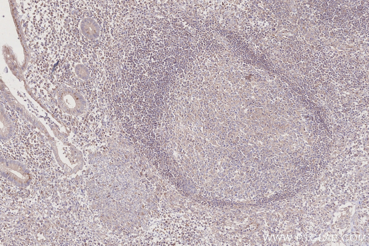Immunohistochemical analysis of paraffin-embedded human appendicitis tissue slide using KHC2796 (AHCYL2 IHC Kit).