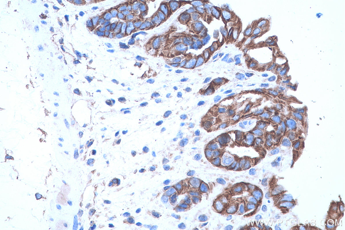 Immunohistochemical analysis of paraffin-embedded mouse colon tissue slide using KHC0658 (AHNAK IHC Kit).