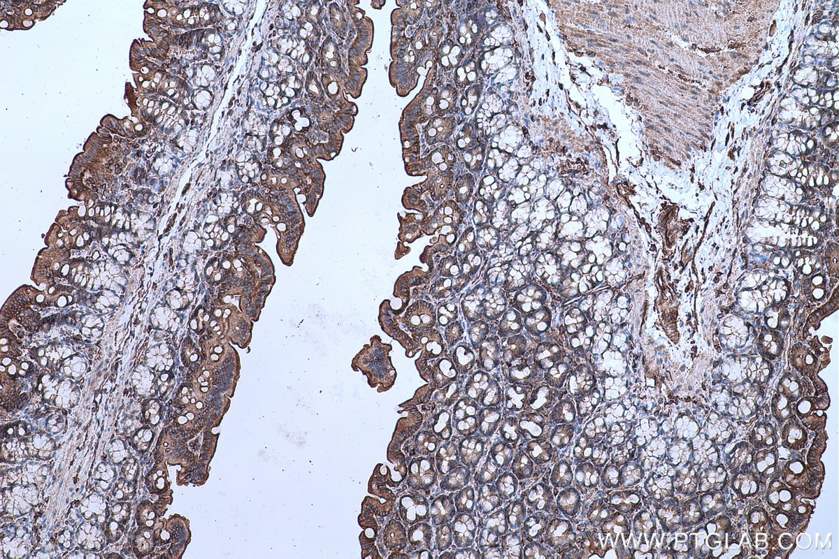 Immunohistochemical analysis of paraffin-embedded rat colon tissue slide using KHC0658 (AHNAK IHC Kit).