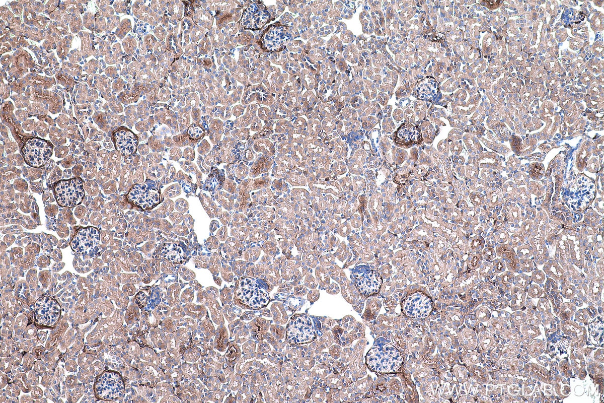 Immunohistochemical analysis of paraffin-embedded mouse kidney tissue slide using KHC0483 (AHSG/Fetuin A IHC Kit).