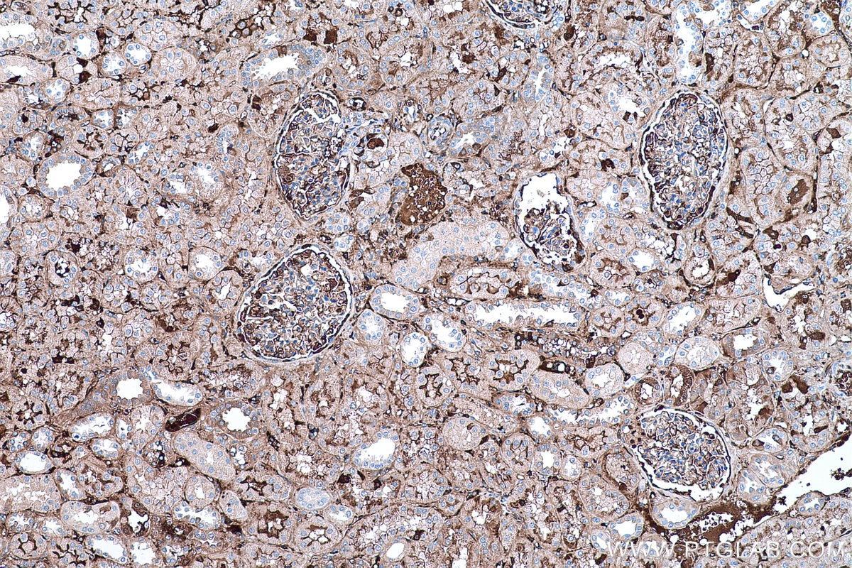 Immunohistochemical analysis of paraffin-embedded human kidney tissue slide using KHC0483 (AHSG/Fetuin A IHC Kit).