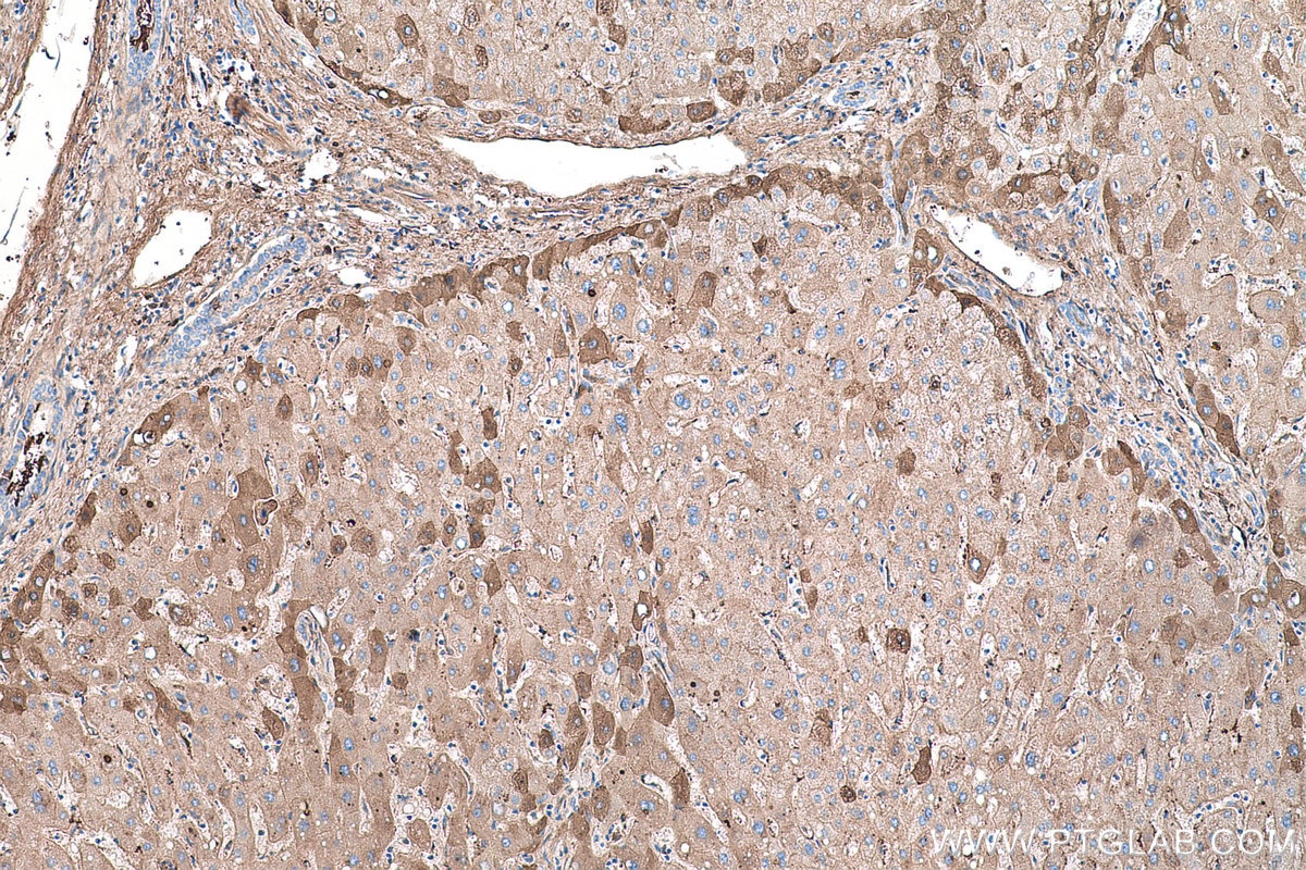 Immunohistochemical analysis of paraffin-embedded human liver tissue slide using KHC0483 (AHSG/Fetuin A IHC Kit).