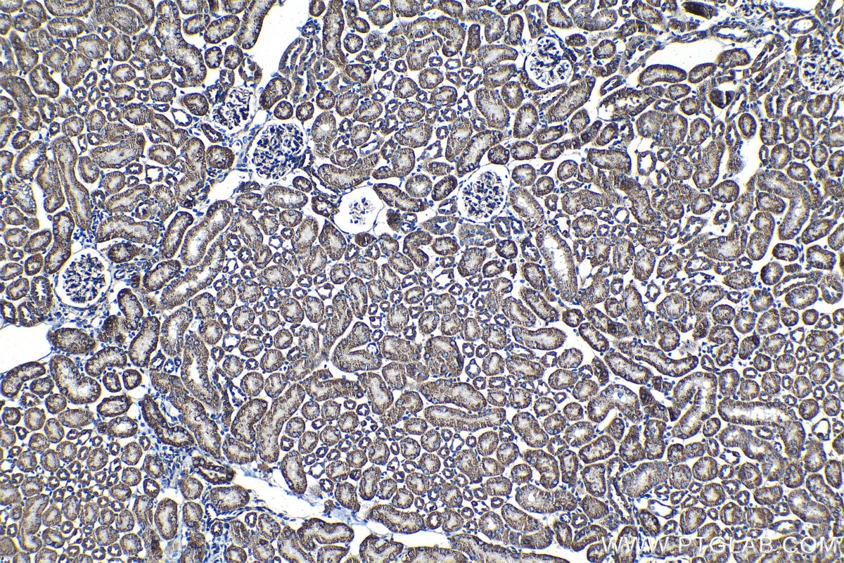 Immunohistochemical analysis of paraffin-embedded mouse kidney tissue slide using KHC1349 (AIFM1 IHC Kit).