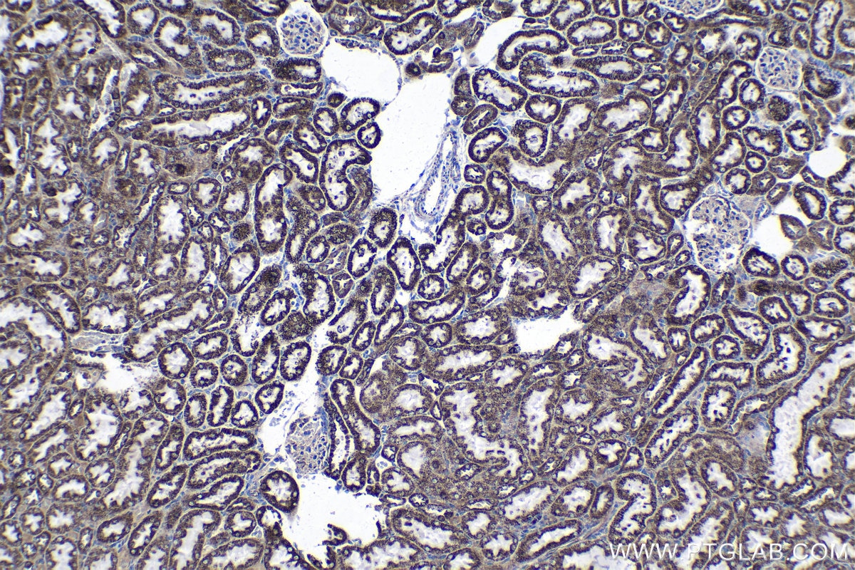 Immunohistochemical analysis of paraffin-embedded rat kidney tissue slide using KHC1349 (AIFM1 IHC Kit).