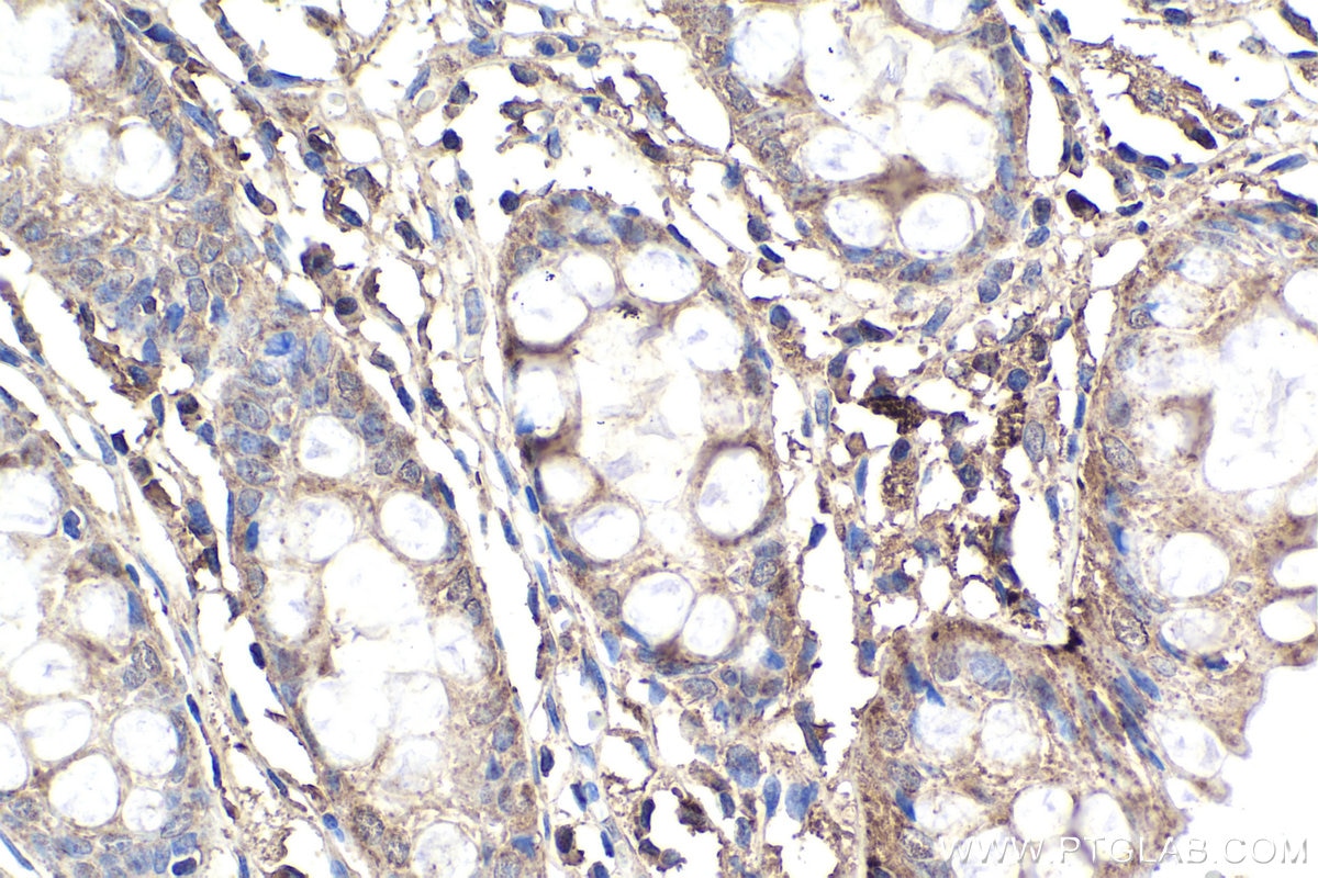 Immunohistochemical analysis of paraffin-embedded human colon tissue slide using KHC1901 (AIFM2 IHC Kit).