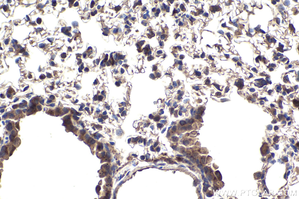 Immunohistochemical analysis of paraffin-embedded mouse lung tissue slide using KHC1901 (AIFM2 IHC Kit).