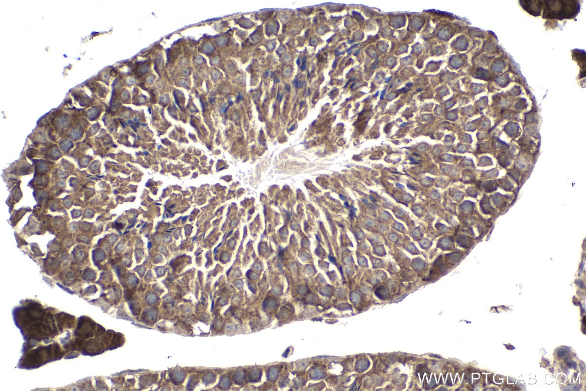 Immunohistochemical analysis of paraffin-embedded mouse testis tissue slide using KHC1901 (AIFM2 IHC Kit).