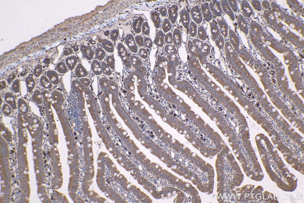 Immunohistochemical analysis of paraffin-embedded rat small intestine tissue slide using KHC1430 (AIM2 IHC Kit).