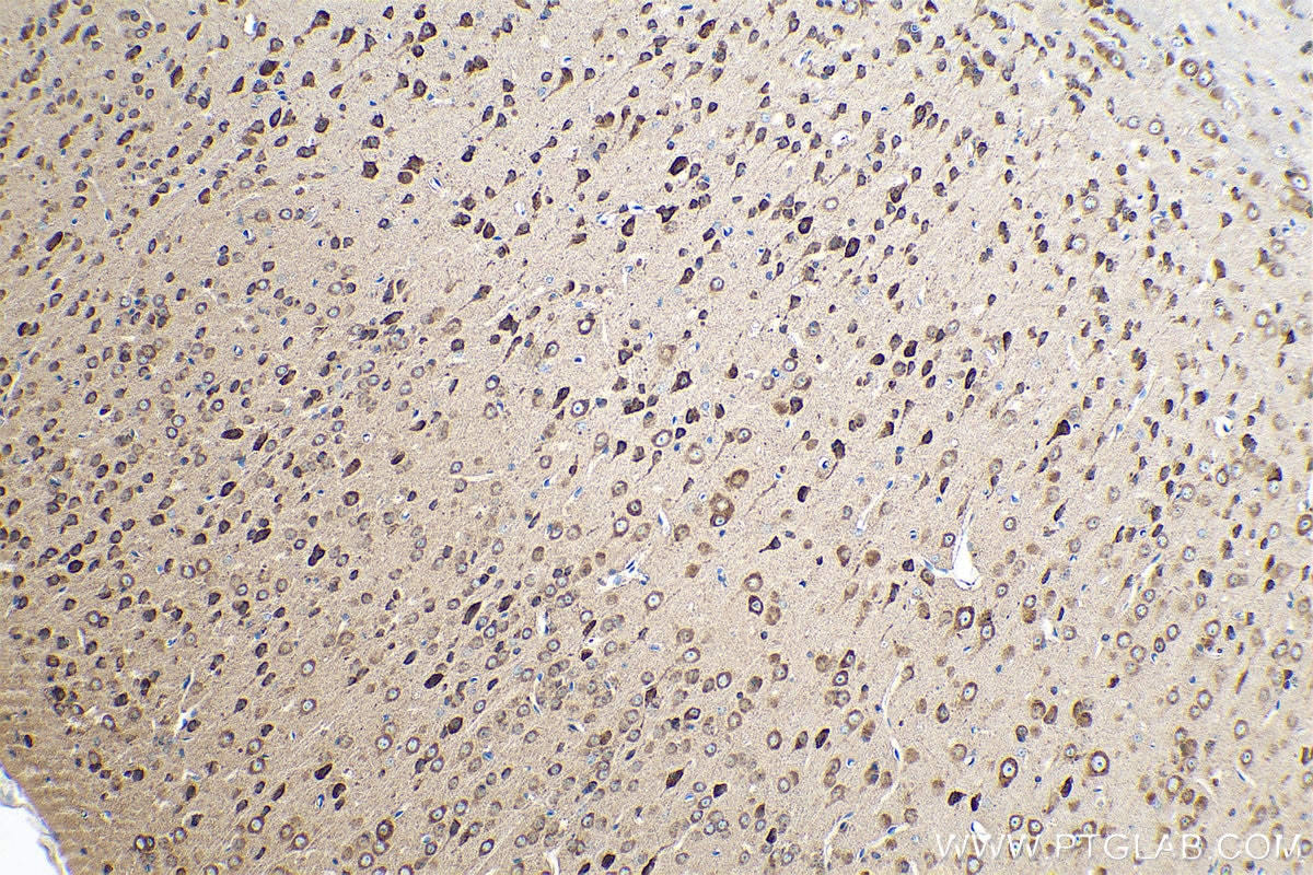 Immunohistochemical analysis of paraffin-embedded mouse brain tissue slide using KHC0845 (AIMP1 IHC Kit).