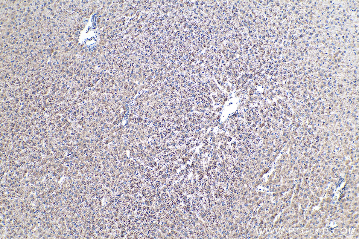 Immunohistochemical analysis of paraffin-embedded rat liver tissue slide using KHC0394 (AIMP2/JTV1 IHC Kit).