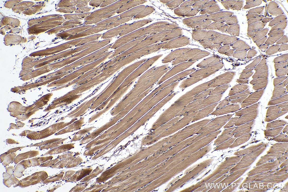 Immunohistochemical analysis of paraffin-embedded mouse skeletal muscle tissue slide using KHC0394 (AIMP2/JTV1 IHC Kit).