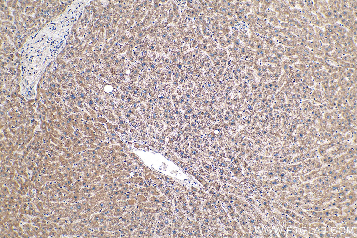 Immunohistochemical analysis of paraffin-embedded human liver tissue slide using KHC0394 (AIMP2/JTV1 IHC Kit).