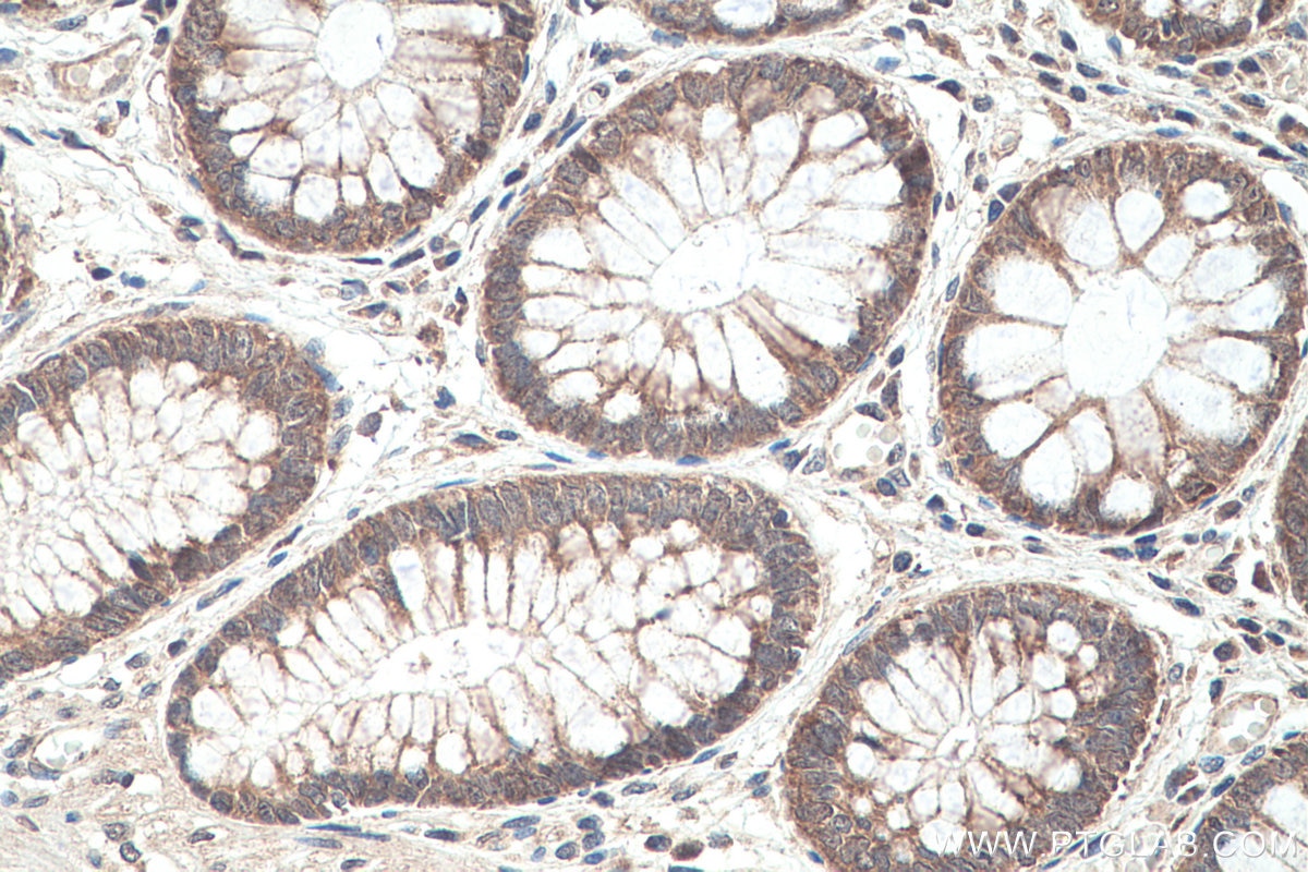 Immunohistochemical analysis of paraffin-embedded human colon tissue slide using KHC0394 (AIMP2/JTV1 IHC Kit).