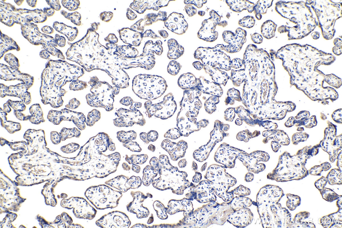 Immunohistochemical analysis of paraffin-embedded human placenta tissue slide using KHC0993 (AIP IHC Kit).
