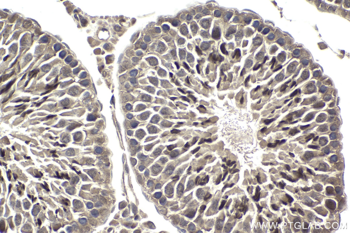 Immunohistochemical analysis of paraffin-embedded rat testis tissue slide using KHC1873 (AJUBA IHC Kit).