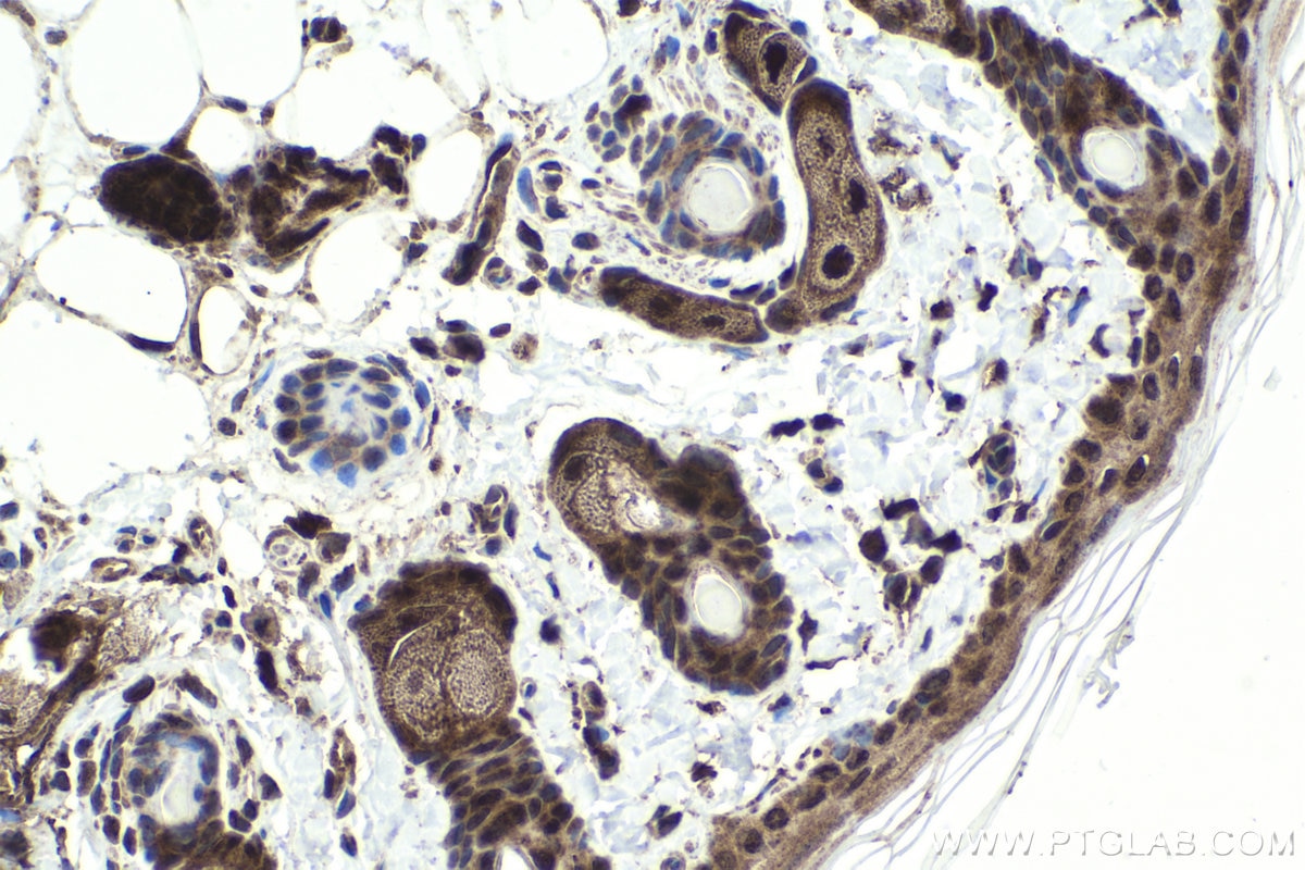 Immunohistochemical analysis of paraffin-embedded rat skin tissue slide using KHC1873 (AJUBA IHC Kit).