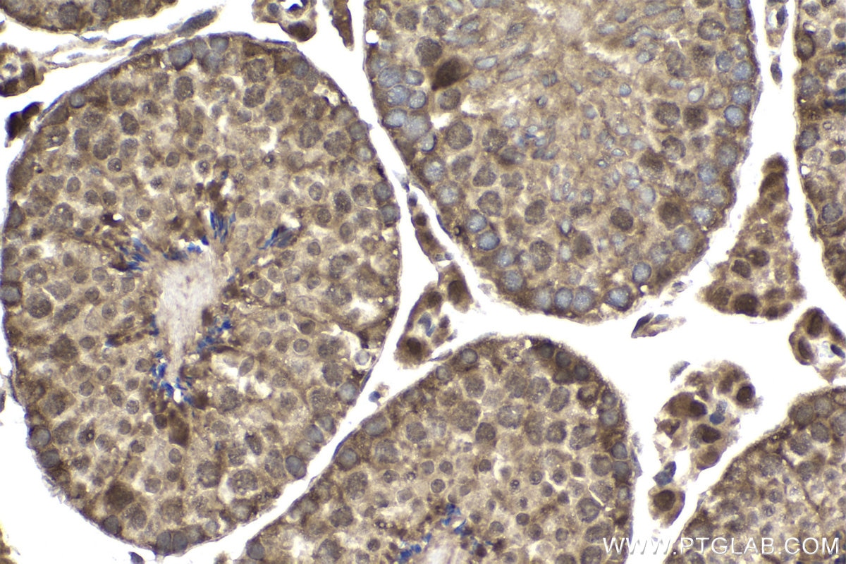 Immunohistochemical analysis of paraffin-embedded mouse testis tissue slide using KHC1873 (AJUBA IHC Kit).