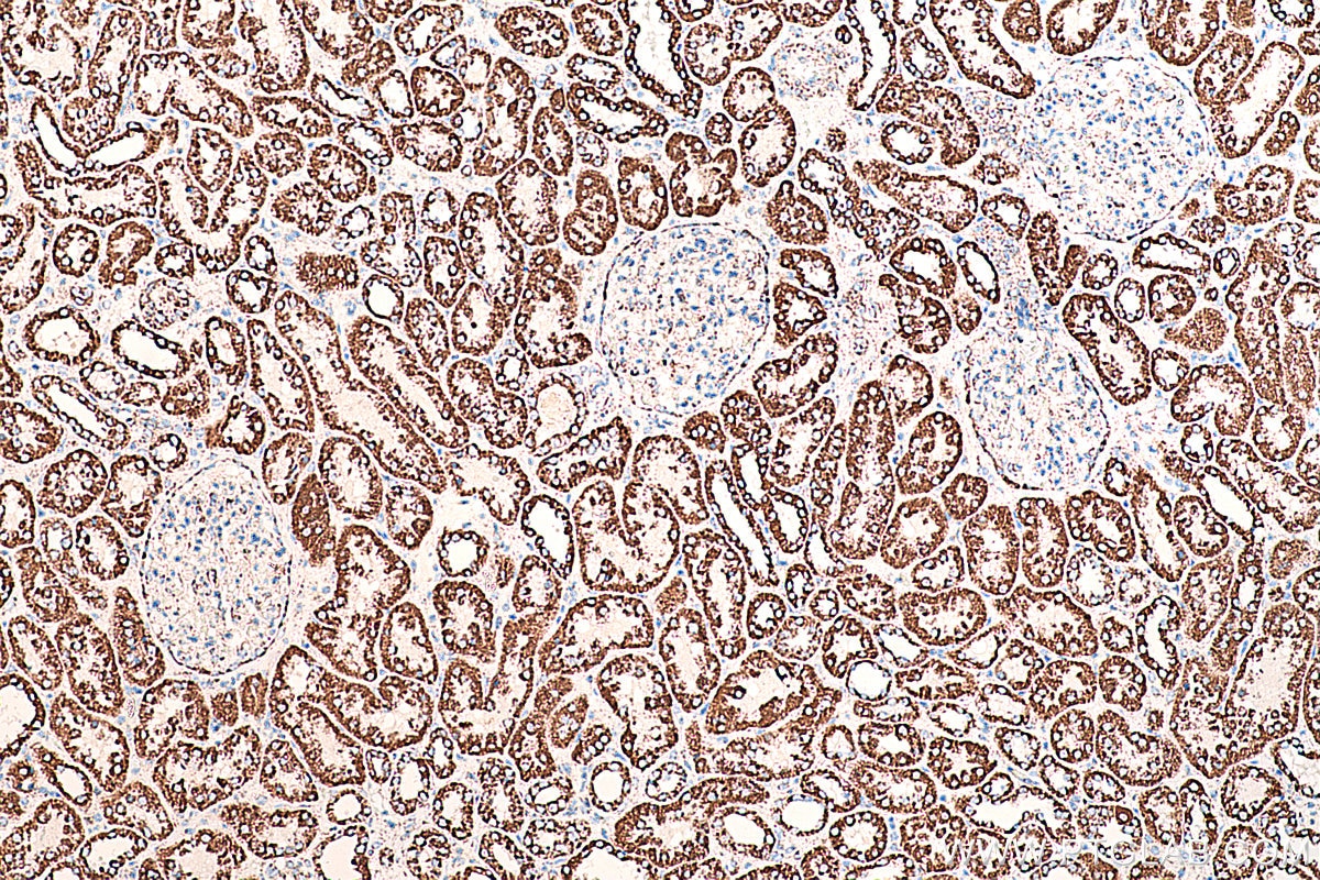 Immunohistochemical analysis of paraffin-embedded human kidney tissue slide using KHC0395 (AK2 IHC Kit).
