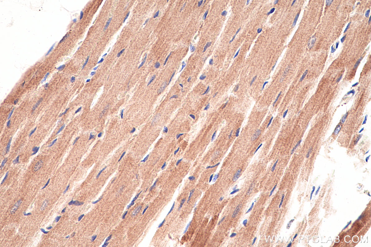 Immunohistochemical analysis of paraffin-embedded rat heart tissue slide using KHC0395 (AK2 IHC Kit).