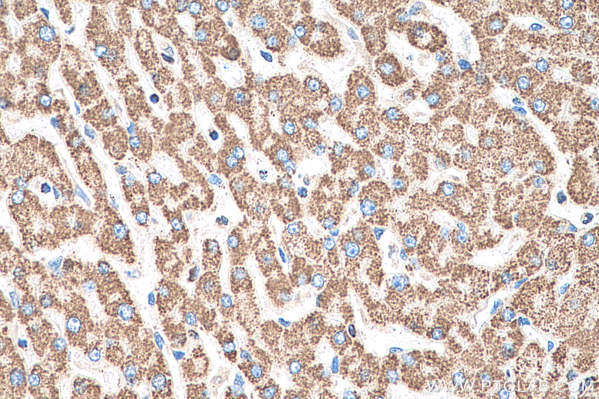 Immunohistochemical analysis of paraffin-embedded human liver tissue slide using KHC0395 (AK2 IHC Kit).