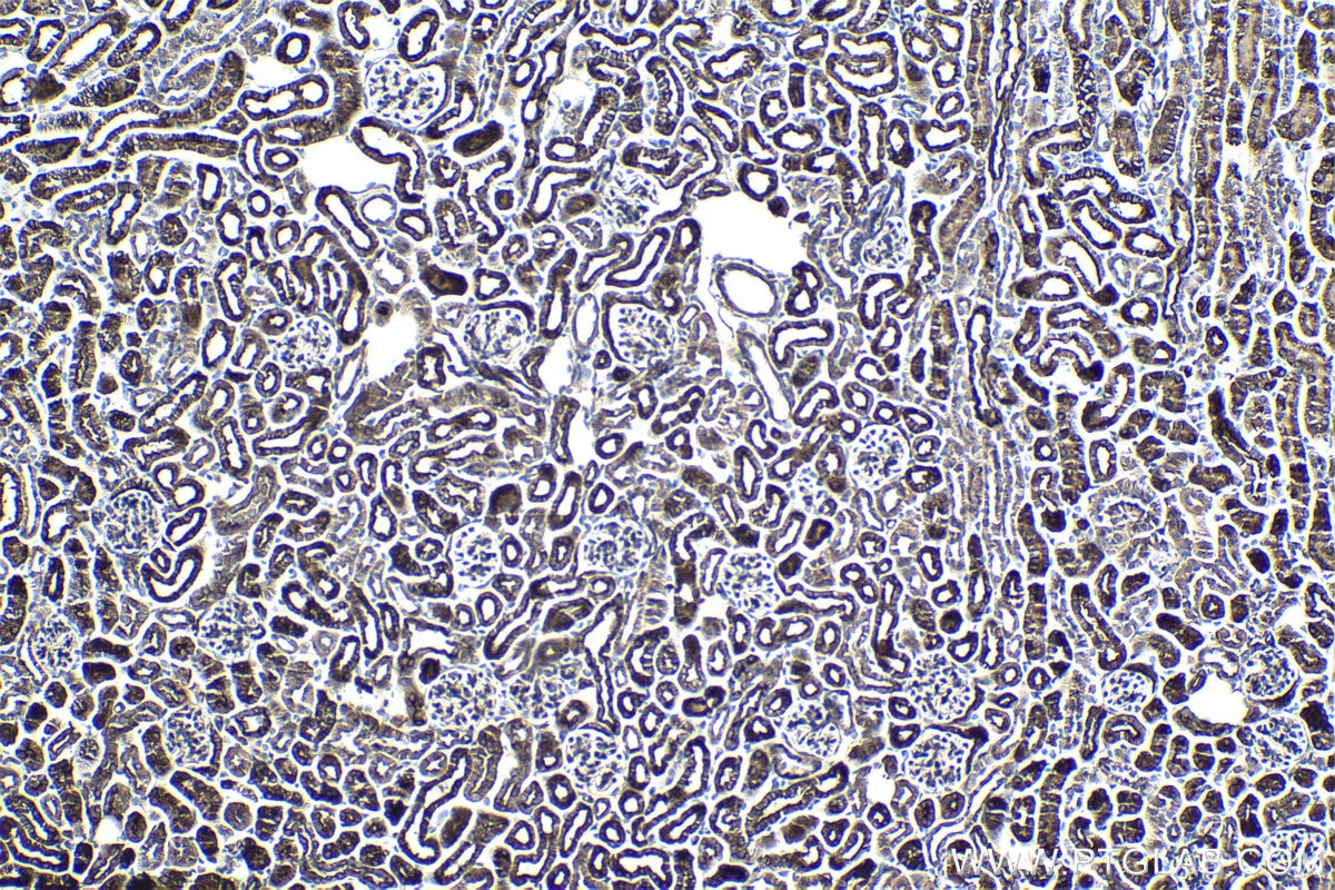 Immunohistochemical analysis of paraffin-embedded mouse kidney tissue slide using KHC0981 (AK4/AK3L1 IHC Kit).