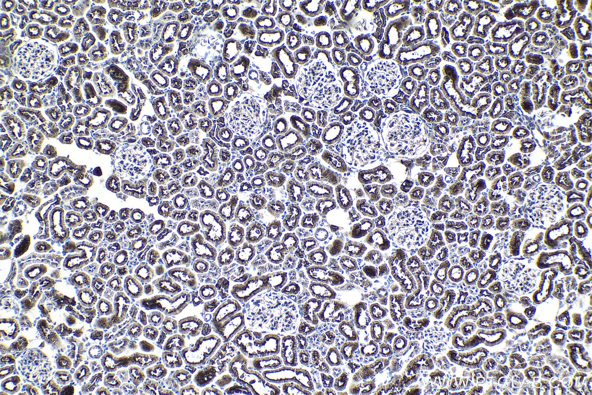 Immunohistochemical analysis of paraffin-embedded rat kidney tissue slide using KHC0981 (AK4/AK3L1 IHC Kit).