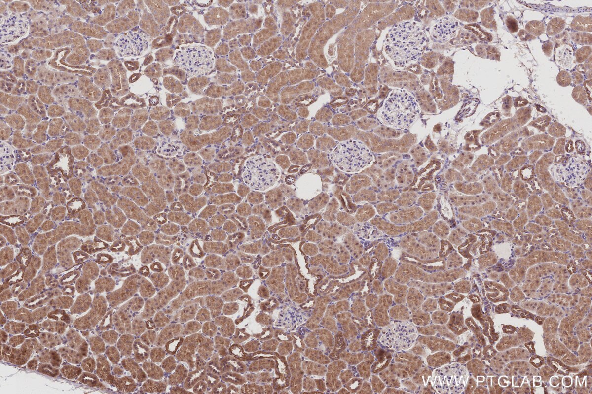 Immunohistochemical analysis of paraffin-embedded rat kidney tissue slide using KHC3023 (AKAP11 IHC Kit).