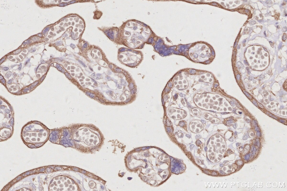 Immunohistochemical analysis of paraffin-embedded human placenta tissue slide using KHC3023 (AKAP11 IHC Kit).