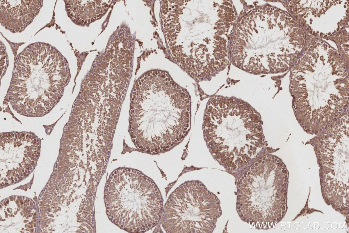Immunohistochemical analysis of paraffin-embedded rat testis tissue slide using KHC3023 (AKAP11 IHC Kit).