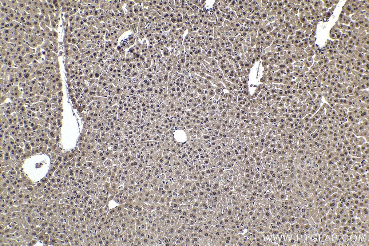 Immunohistochemical analysis of paraffin-embedded mouse liver tissue slide using KHC1691 (AKAP13 IHC Kit).