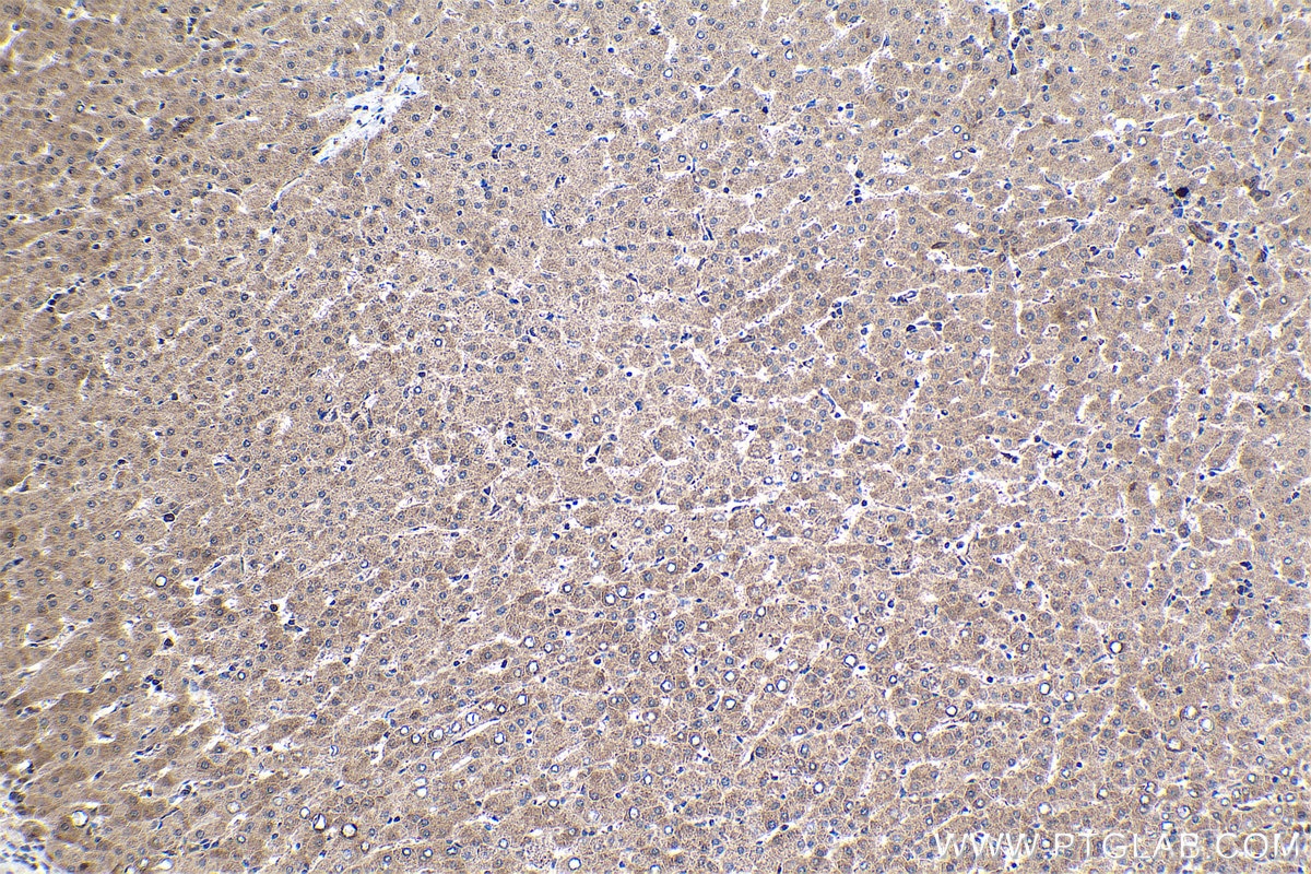 Immunohistochemical analysis of paraffin-embedded human liver tissue slide using KHC1691 (AKAP13 IHC Kit).