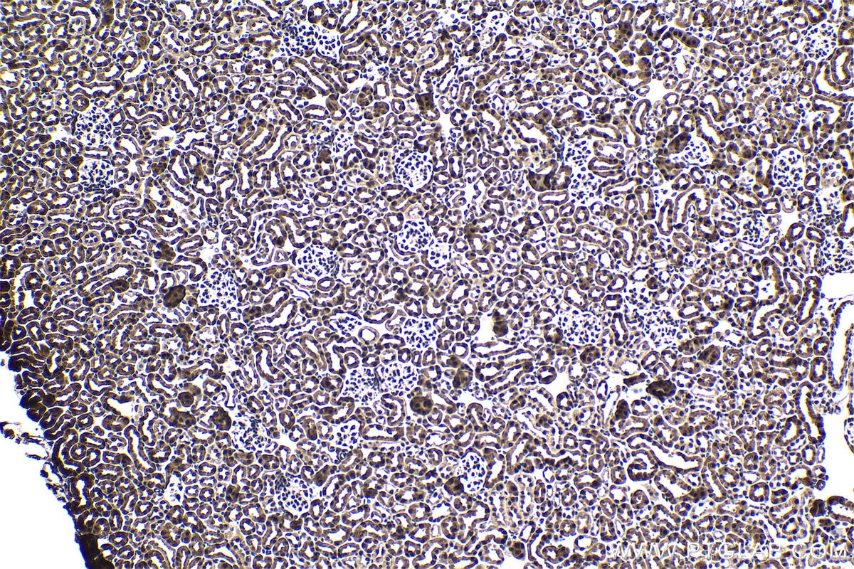 Immunohistochemical analysis of paraffin-embedded mouse kidney tissue slide using KHC1691 (AKAP13 IHC Kit).