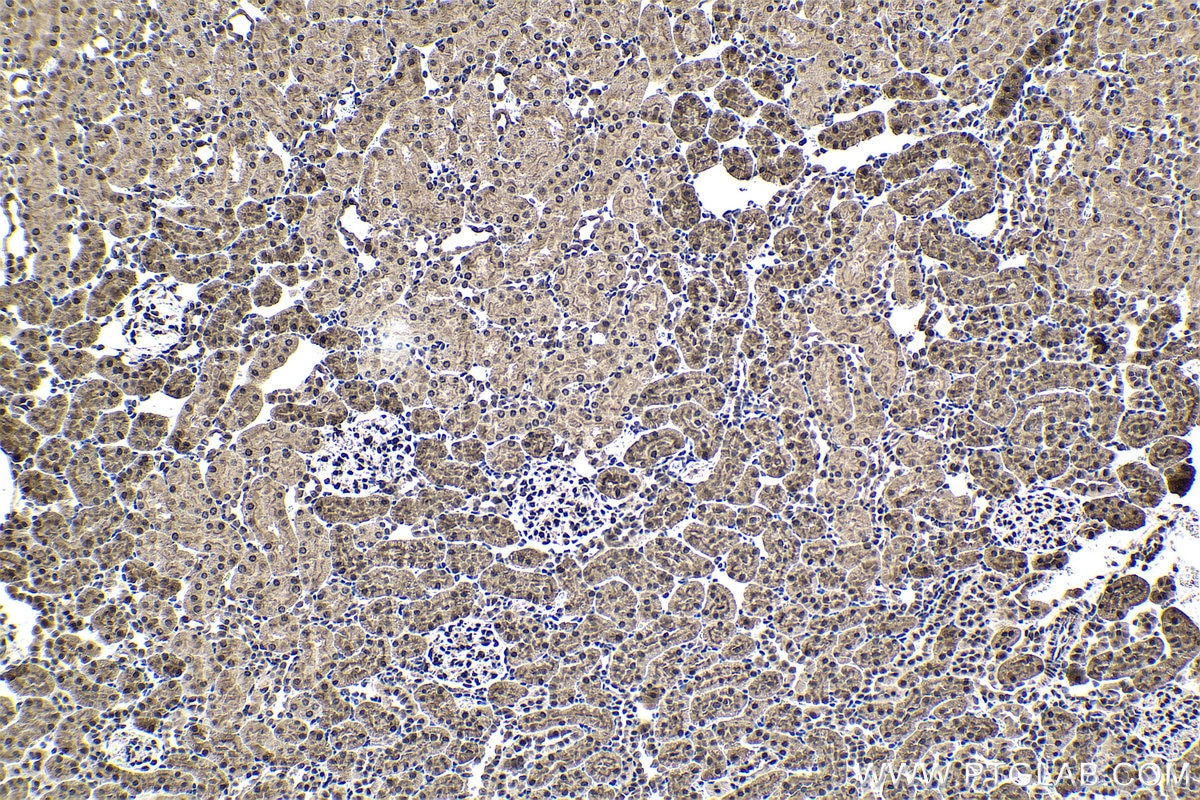 Immunohistochemical analysis of paraffin-embedded rat kidney tissue slide using KHC1691 (AKAP13 IHC Kit).