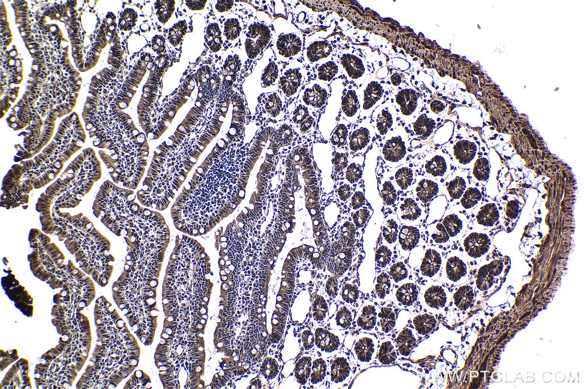 Immunohistochemical analysis of paraffin-embedded rat small intestine tissue slide using KHC1691 (AKAP13 IHC Kit).