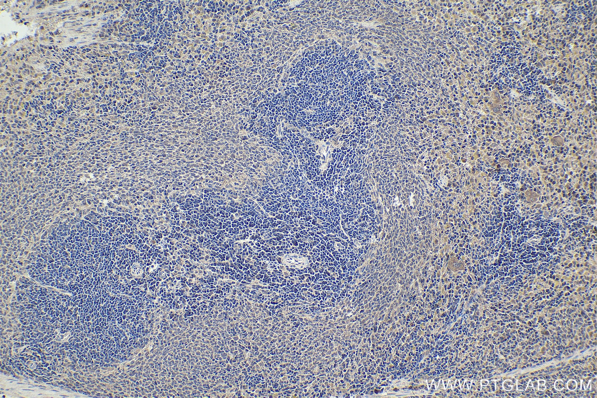 Immunohistochemical analysis of paraffin-embedded rat spleen tissue slide using KHC1803 (AKNA IHC Kit).