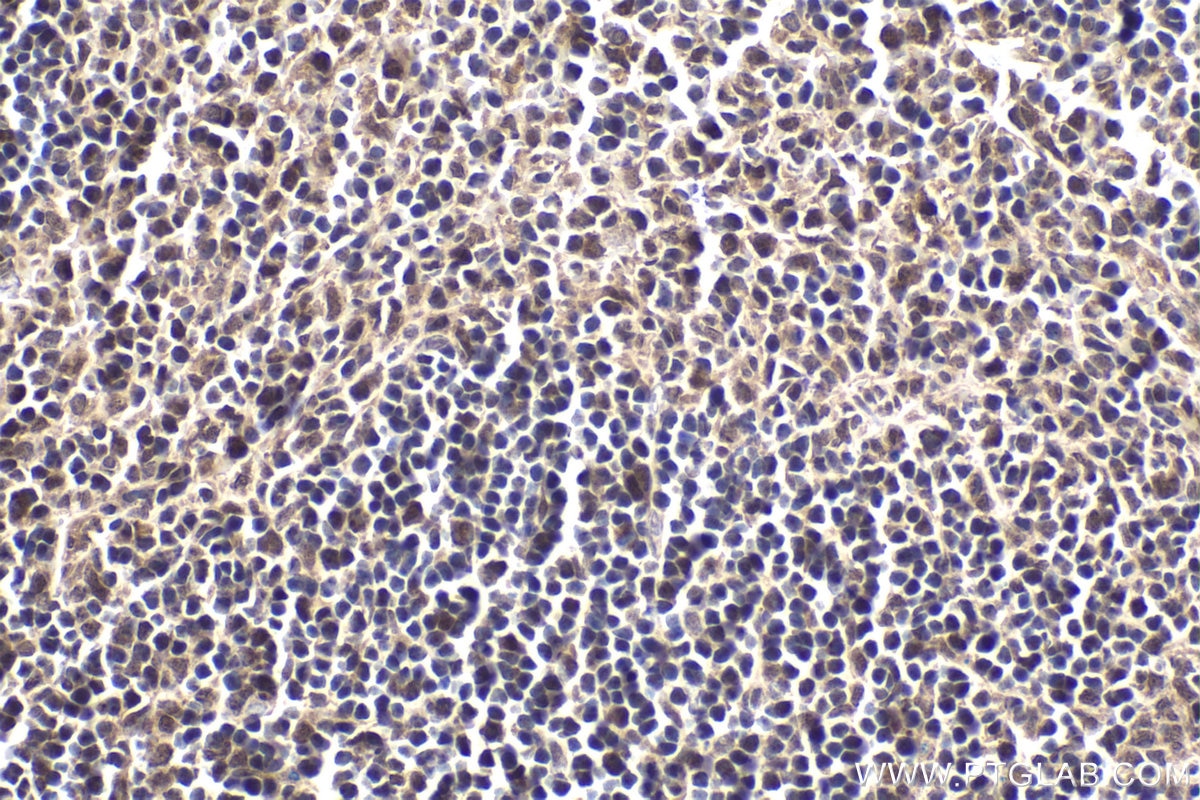 Immunohistochemical analysis of paraffin-embedded mouse spleen tissue slide using KHC1803 (AKNA IHC Kit).