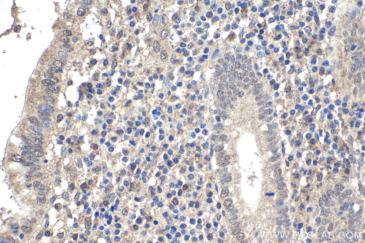 Immunohistochemical analysis of paraffin-embedded human appendicitis tissue slide using KHC1803 (AKNA IHC Kit).