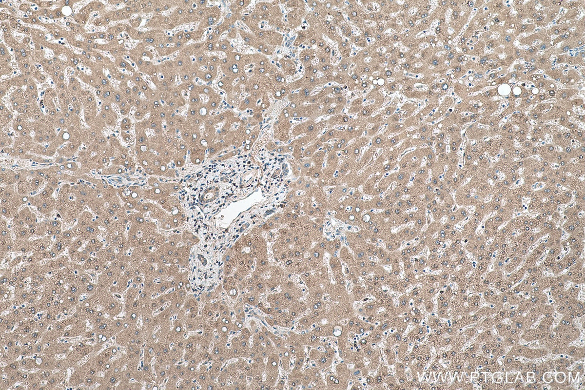 Immunohistochemical analysis of paraffin-embedded human liver tissue slide using KHC0571 (AKR1A1 IHC Kit).