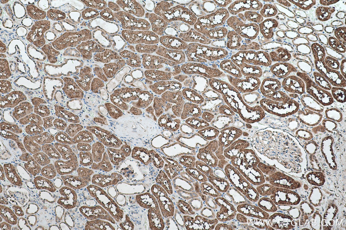 Immunohistochemical analysis of paraffin-embedded human kidney tissue slide using KHC0571 (AKR1A1 IHC Kit).