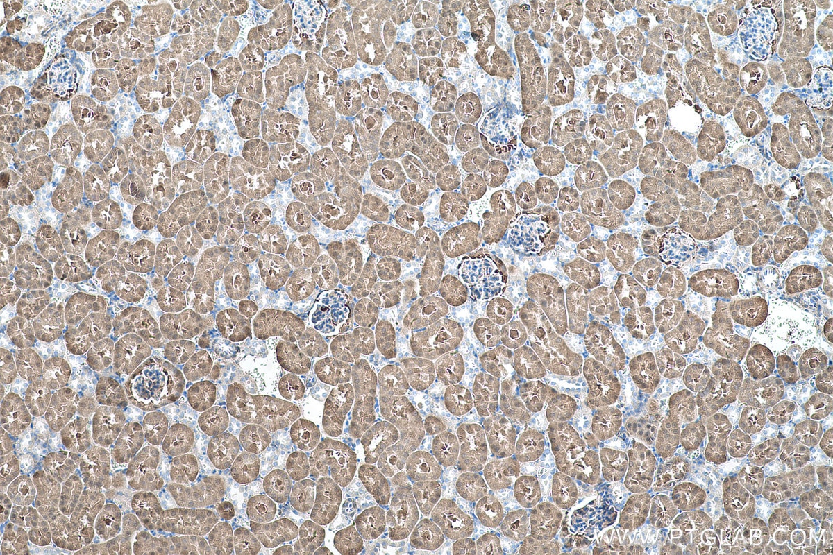 Immunohistochemical analysis of paraffin-embedded mouse kidney tissue slide using KHC0571 (AKR1A1 IHC Kit).